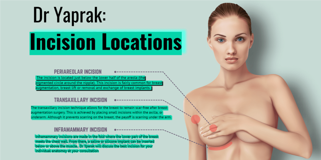 Breast Augmentation – Implants - Dr Yaprak Plastic Surgeon